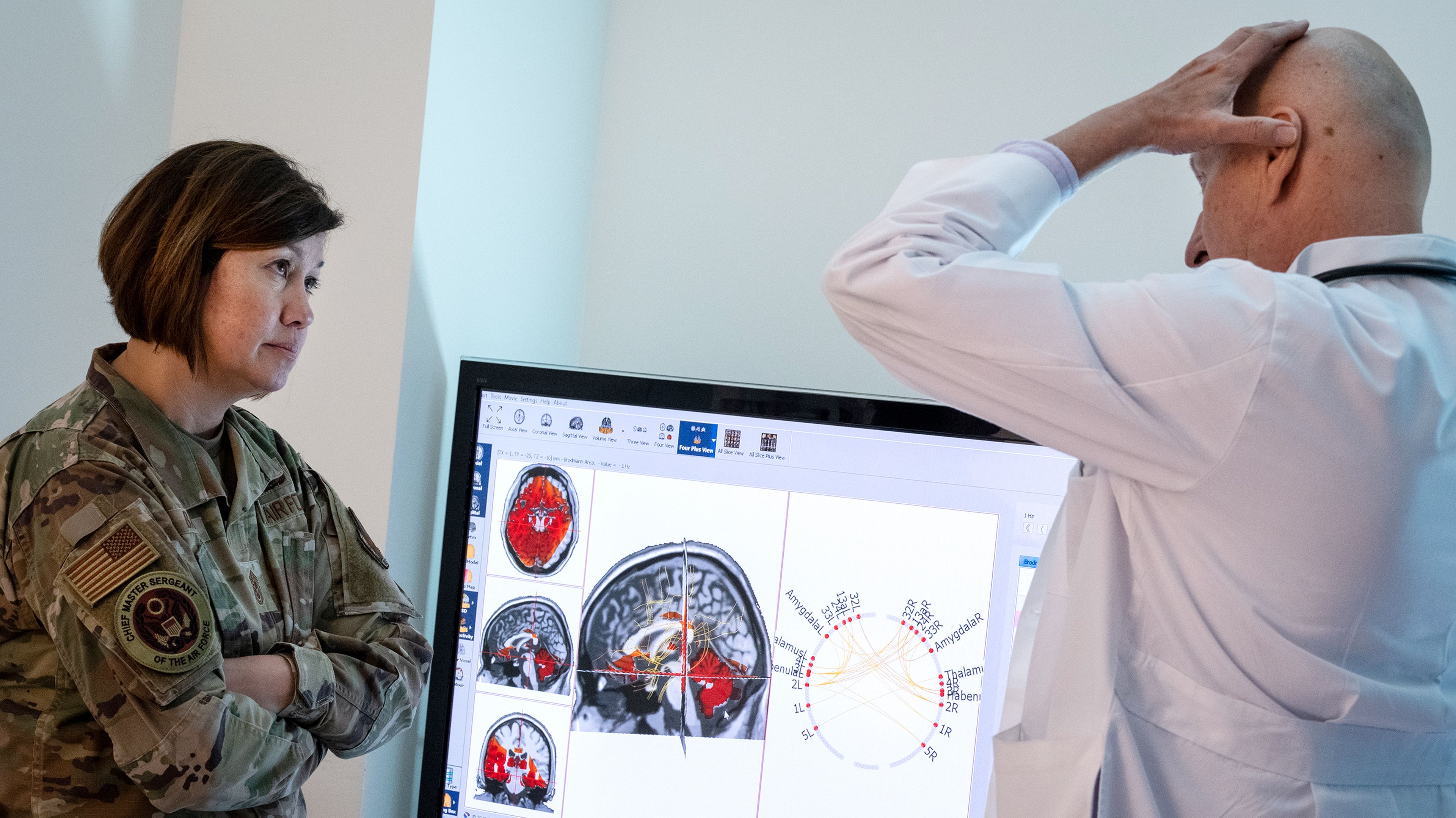 Specific Blood Protein Linked to Lower Risk of Depression and PTSD After TBI