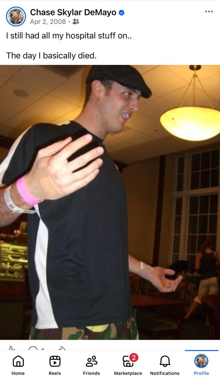 Chase DeMayo, a former U.S. Air Force public affairs officer, pictured on Facebook after a near-death experience in 2008. (Facebook).