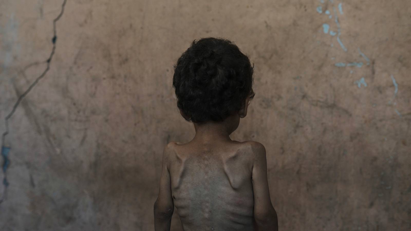 Israel's Leader Claims No One in Gaza Is Starving. Data and Witnesses ...